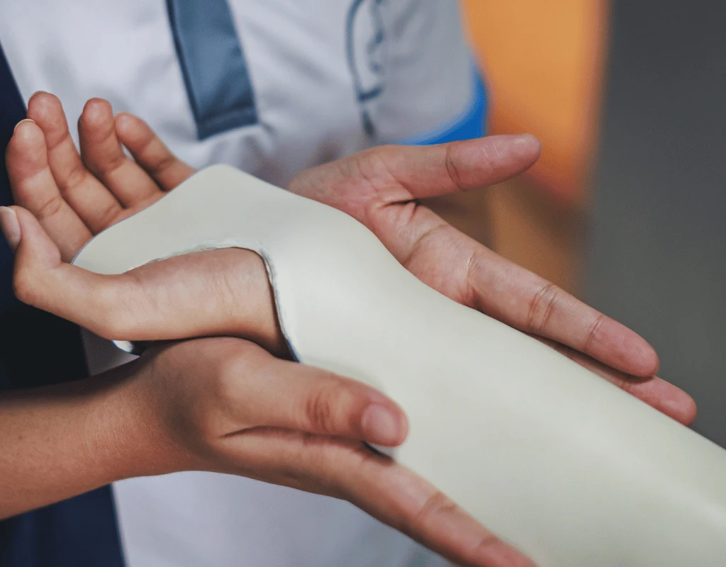 Clinician moulding a custom thermoplastic splint around a patients hand and wrist